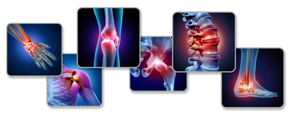 Joint and Cartilage Health